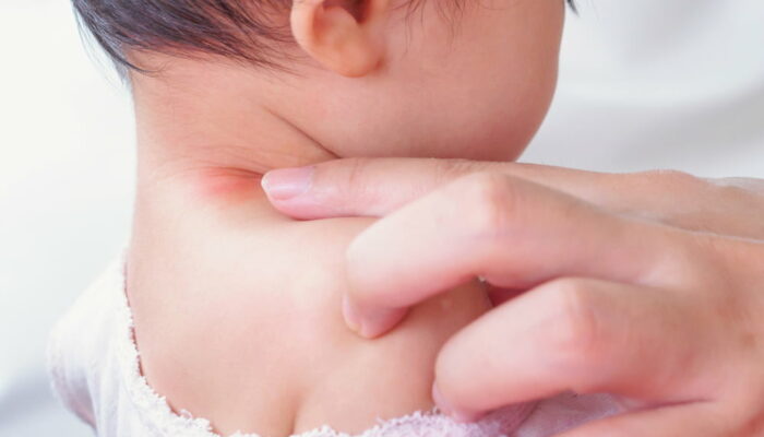 17 soap ingredients that could trigger eczema in kids