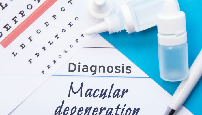 Macular Degeneration – Causes, Symptoms, and More
